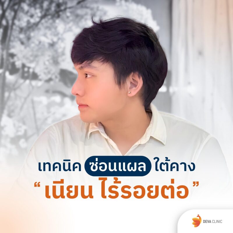 เทคนิคซ่อนแผล ดูดไขมันเหนียง