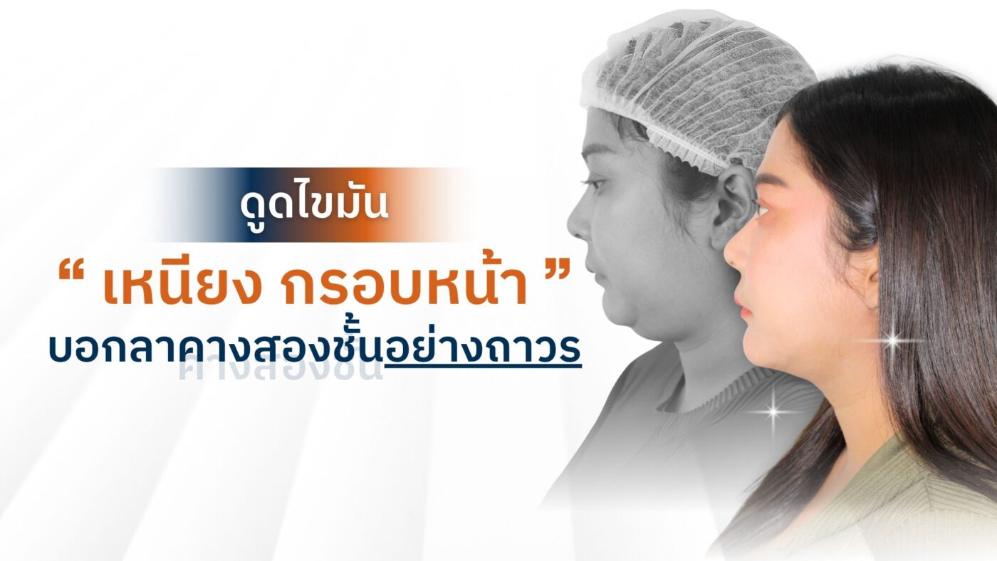 ดูดไขมันเหนียง กรอบหน้า