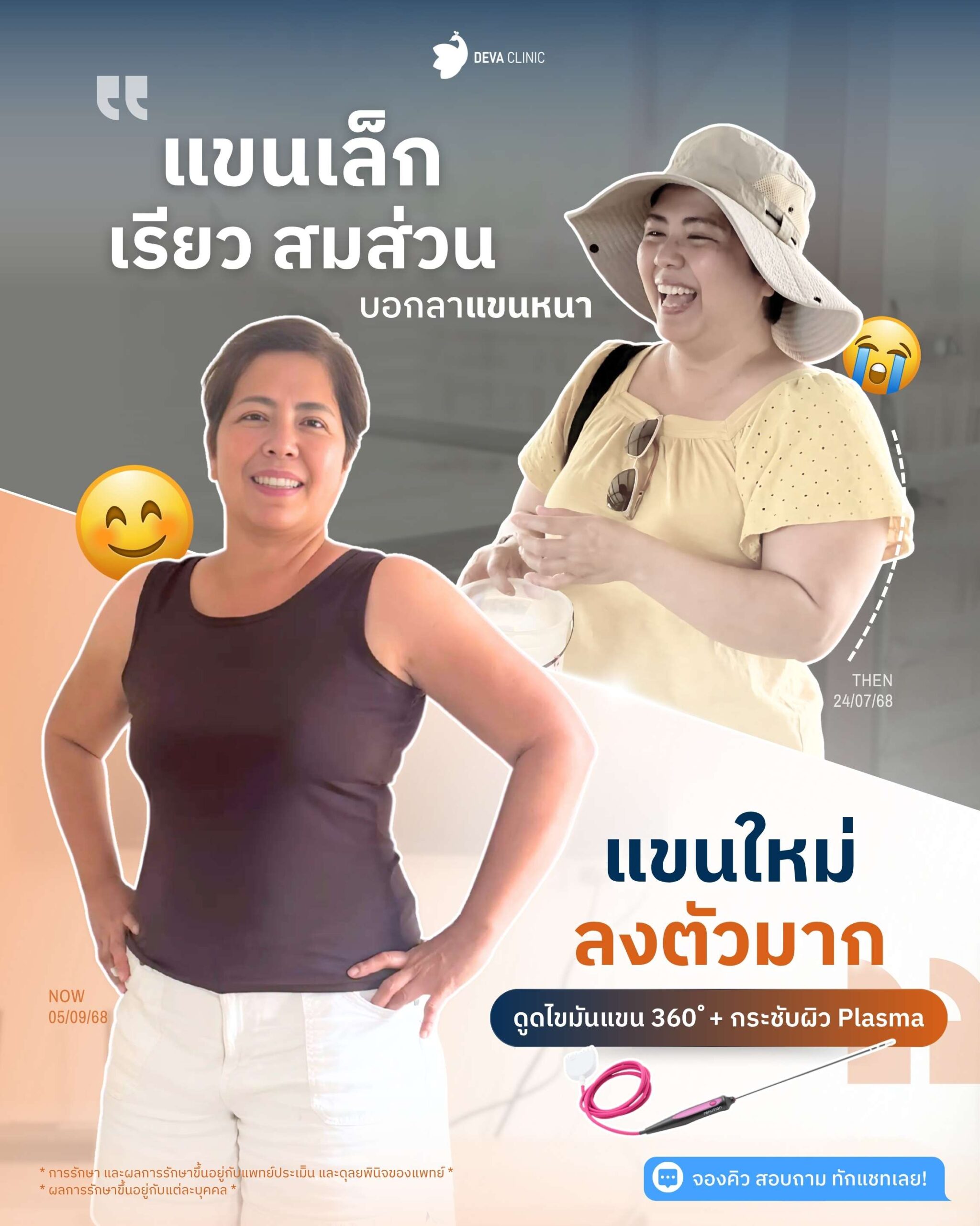 รีวิว Plasma