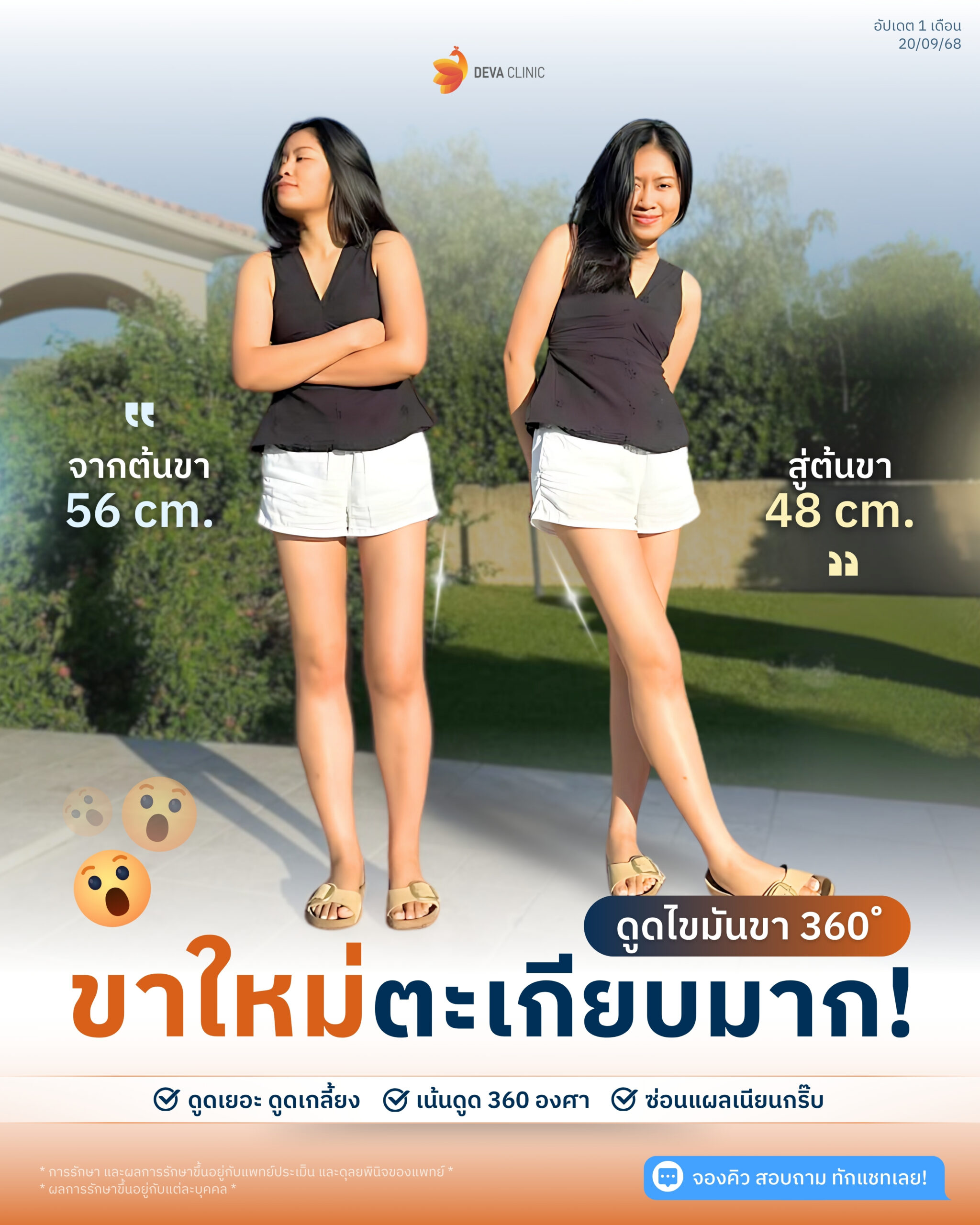 รีวิวขา