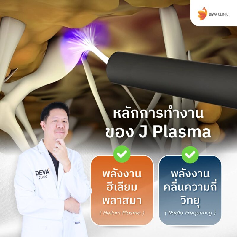 หลักการทำงานของ J Plasma