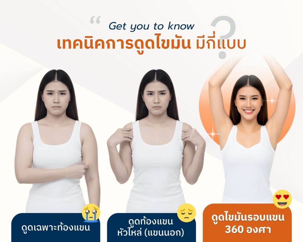 เทคนิคดูดไขมันต้นแขน