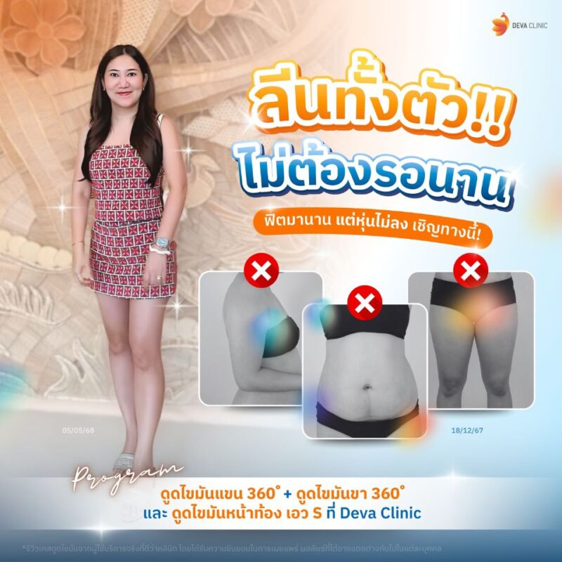 รีวิวเคสคุณปุ้ย