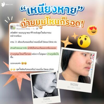 รีวิวแชท ดูดเหนียง 2