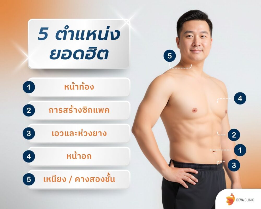 5 ตำแหน่งยอดฮิต ดูดไขมันผู้ชาย