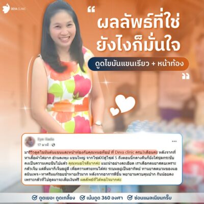 รีวิวแชท ดูดไขมันต้นแขน 3