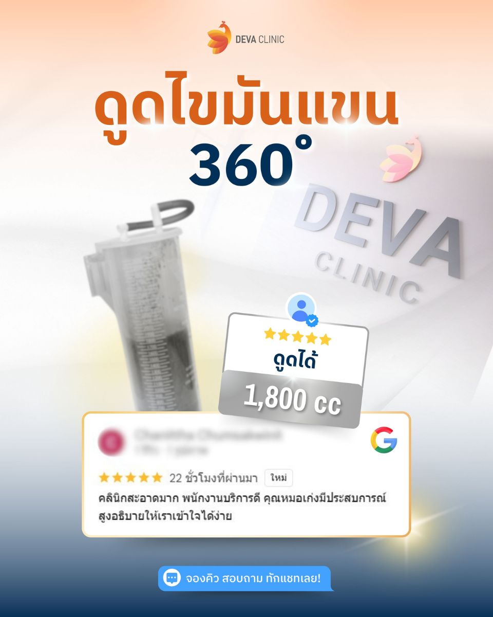 รีวิว GG ดูดไขมันปลอดภัย 2