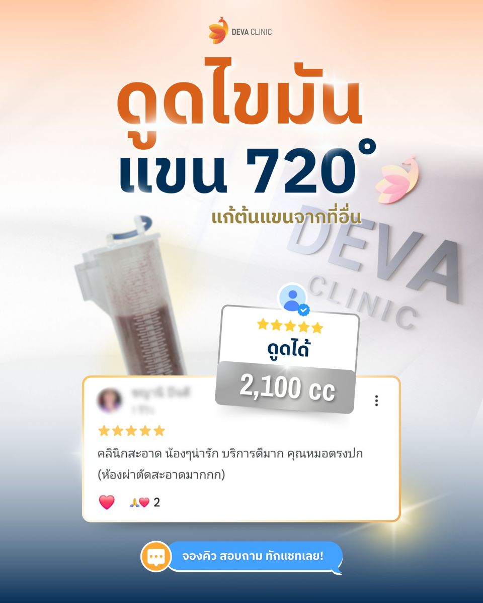 รีวิว GG ดูดไขมันปลอดภัย 3