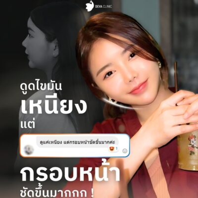 รีวิวแชท ดูดเหนียง 1