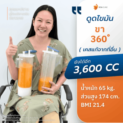 คลินิกดูดไขมัน ตอบโจทย์ด้านผลลัพธ์: ด้วยเทคนิคเน้นดูดเยอะ ดูดเกลี้ยง 12