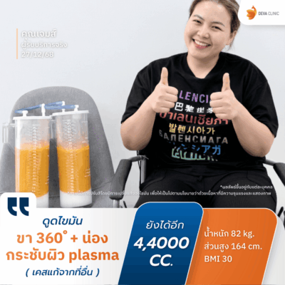คลินิกดูดไขมัน ตอบโจทย์ด้านผลลัพธ์: ด้วยเทคนิคเน้นดูดเยอะ ดูดเกลี้ยง 2
