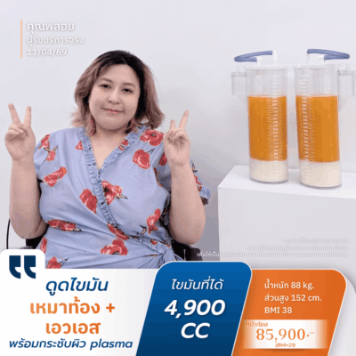 คลินิกดูดไขมัน ตอบโจทย์ด้านผลลัพธ์: ด้วยเทคนิคเน้นดูดเยอะ ดูดเกลี้ยง 3