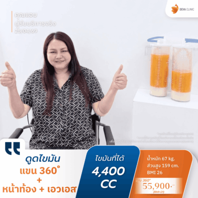 คลินิกดูดไขมัน ตอบโจทย์ด้านผลลัพธ์: ด้วยเทคนิคเน้นดูดเยอะ ดูดเกลี้ยง 7
