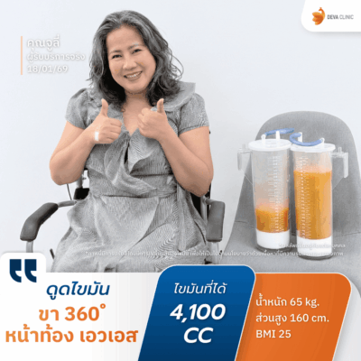 คลินิกดูดไขมัน ตอบโจทย์ด้านผลลัพธ์: ด้วยเทคนิคเน้นดูดเยอะ ดูดเกลี้ยง 8