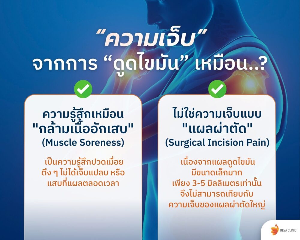 ความเจ็บจากการดูดไขมัน