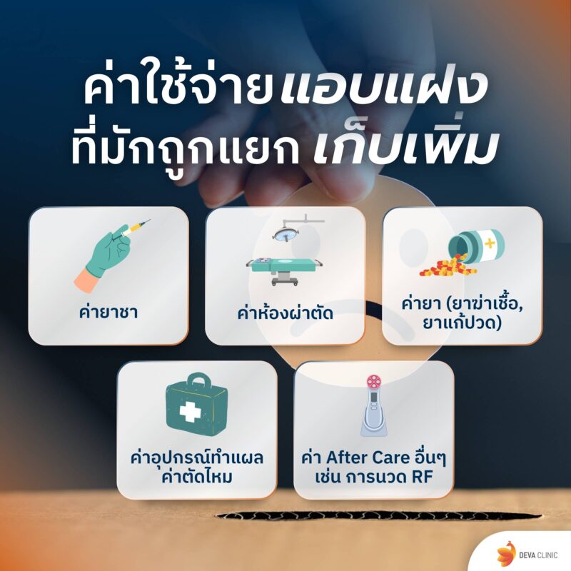 ค่าใช้จ่ายแอบแฝง