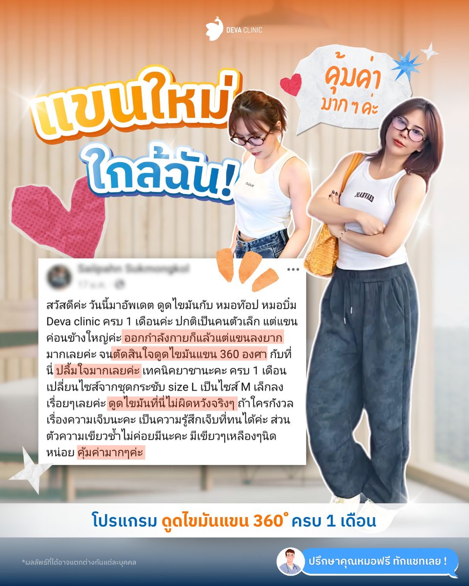 รีวิวความประทับใจ ดูดไขมันต้นแขน สายป่าน