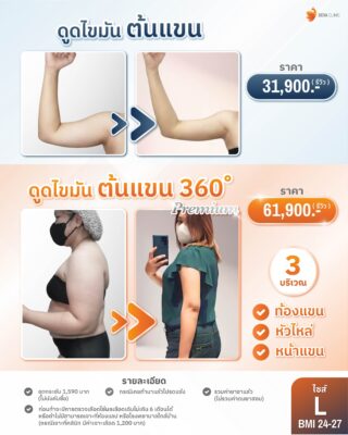 ราคาดูดไขมันต้นแขน L