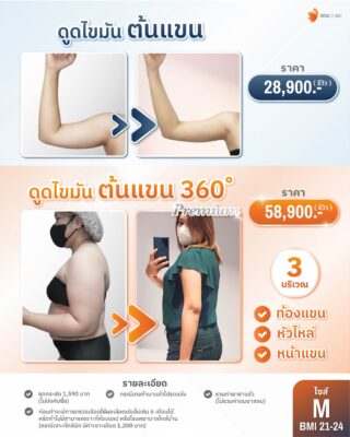 ราคาดูดไขมันต้นแขน M