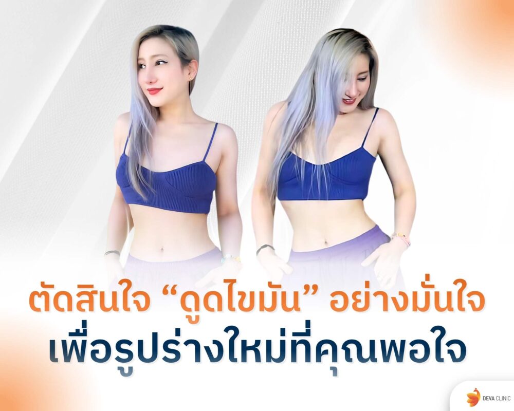 ตัดสินใจดูดไขมันอย่างมั่นใจ