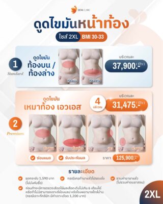 ราคาดูดไขมันหน้าท้อง 2XL