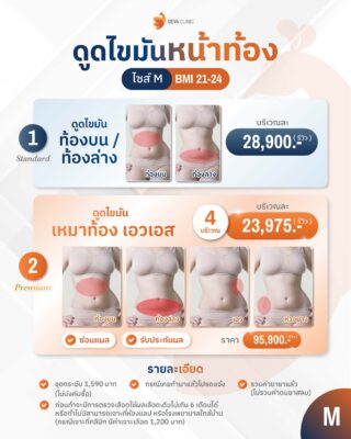 ราคาดูดไขมันหน้าท้อง M