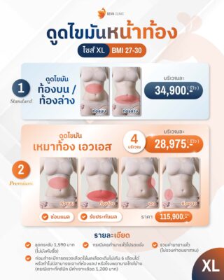 ราคาดูดไขมันหน้าท้อง XL