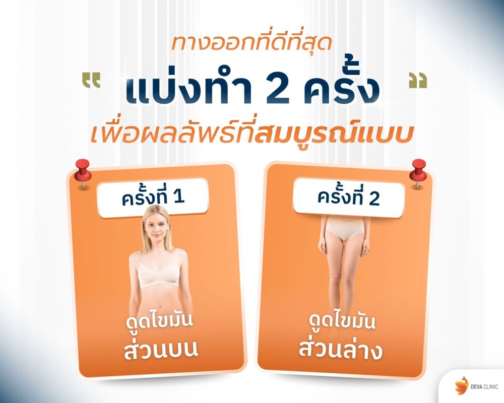 แบ่งดูดไขมัน 2 รอบ