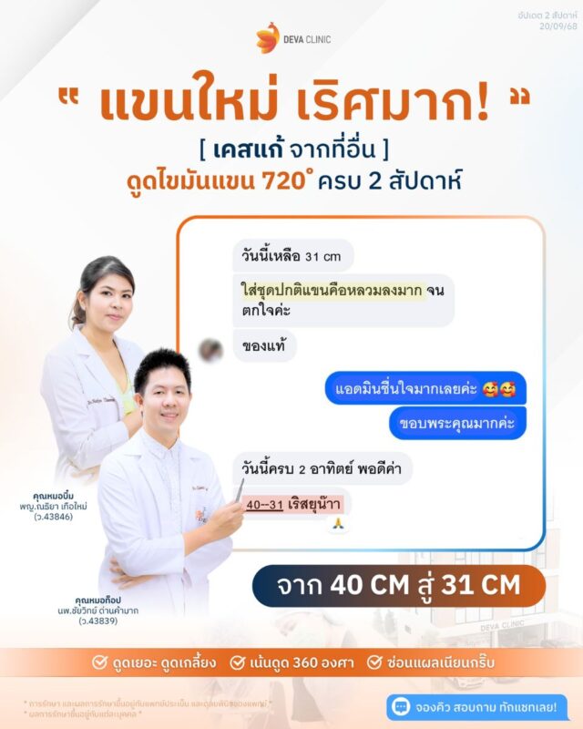 รีวิวความประทับใจ ดูดไขมันต้นแขน ราคา 2