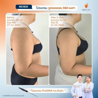 รีวิวแขนพลัสไซซ์ 5