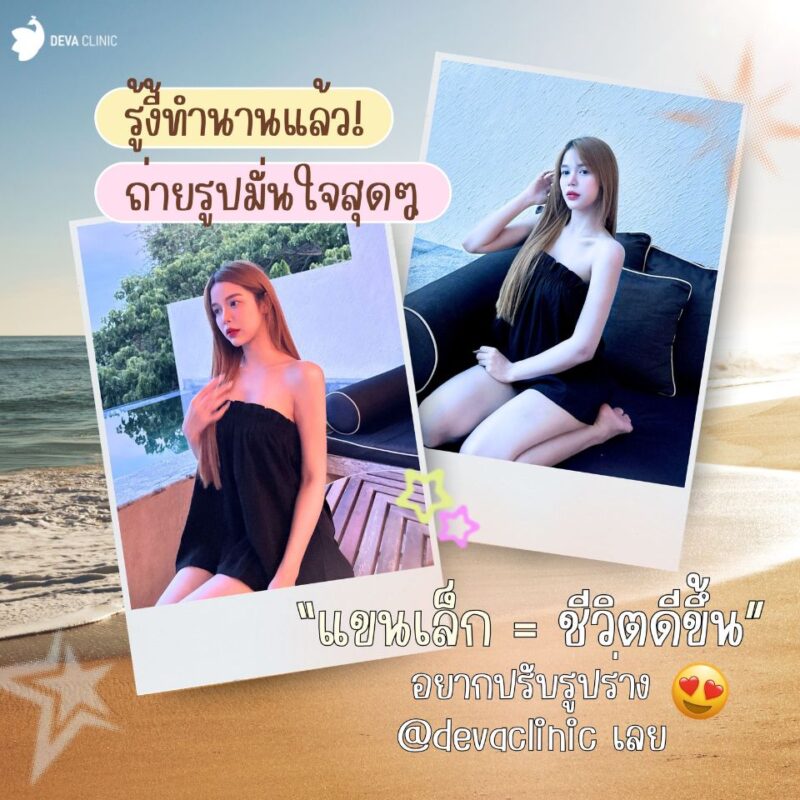 รีวิวแขนใหญ่ หลังดูดแขน 2