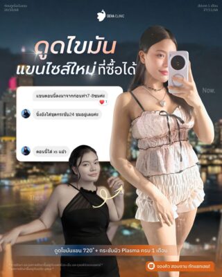 รีวิวต้นแขนใหญ่กรรมพันธุ์ คุณนิ้ง