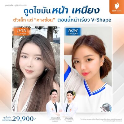 รีวิวดูดเหนียง คุณออมสิน