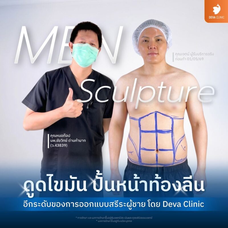 ดูดไขมันผู้ชาย ปั้นหน้าท้องลีน Six Pack ชัดเจน ปลอดภัย โดย Deva Clinic