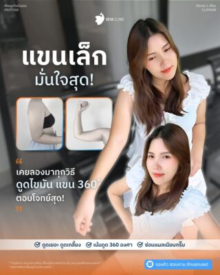 รีวิวต้นแขนใหญ่กรรมพันธุ์ คุณบิว