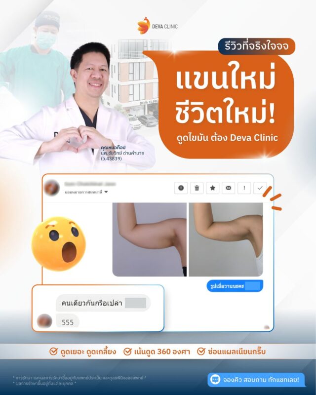 รีวิวความประทับใจ ดูดไขมันต้นแขน ราคา 3
