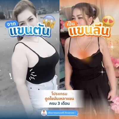 รีวิวแขนพลัสไซซ์ 2