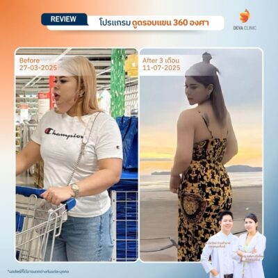 รีวิวแขนพลัสไซซ์ 5