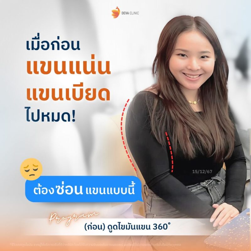 ดู “ล่ำ” เหมือนนักกีฬา