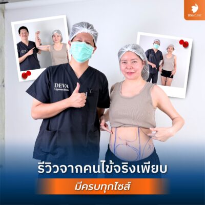 เช็กสิลิสต์เลือก “หมอดูดไขมันเก่งๆ” ดูดไขมันที่ไหนดี ให้ปลอดภัย หุ่นสับ ไม่เป็นคลื่น 05