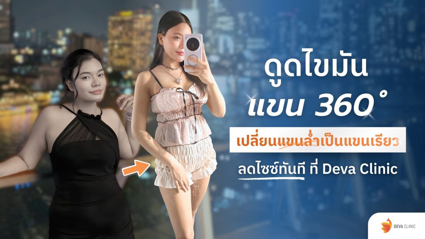 ดูดไขมันแขน 360 องศา