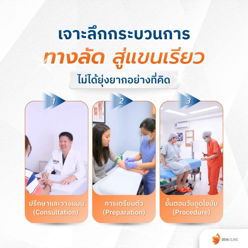 ทางลัดสู่แขนเรีย