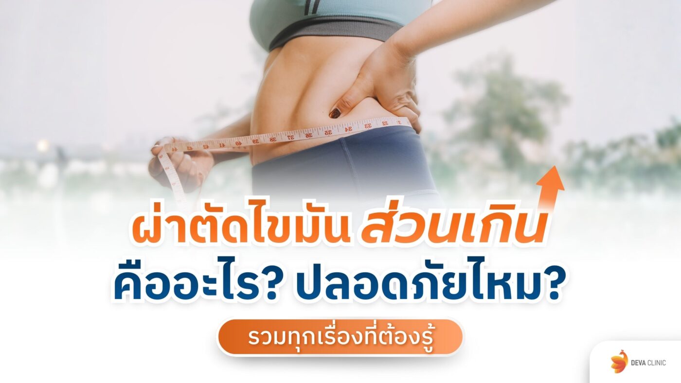 ผ่าตัดไขมันส่วนเกิน