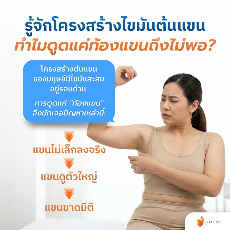 รู้จักโครงสร้างแขน