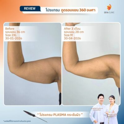 รีวิว J plasma 15