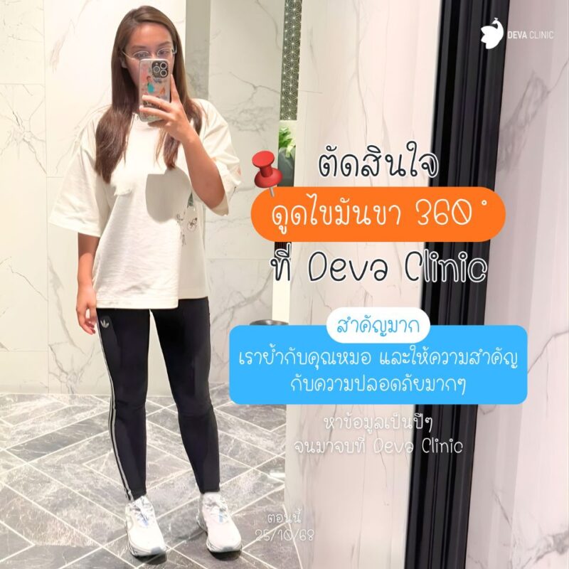 คุณชารีฟ ตัดสินใจดูดไขมันต้นขา deva clinic