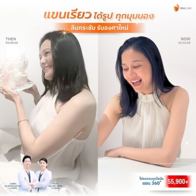 รีวิวดูดไขมันต้นแขน ไกด์