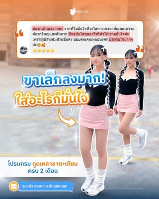 รีวิวความประทับใจ ดูดไขมันขานอก 7