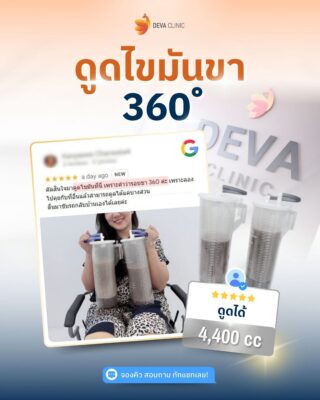 รีวิว GG ดูดไขมันต้นขานอก 6