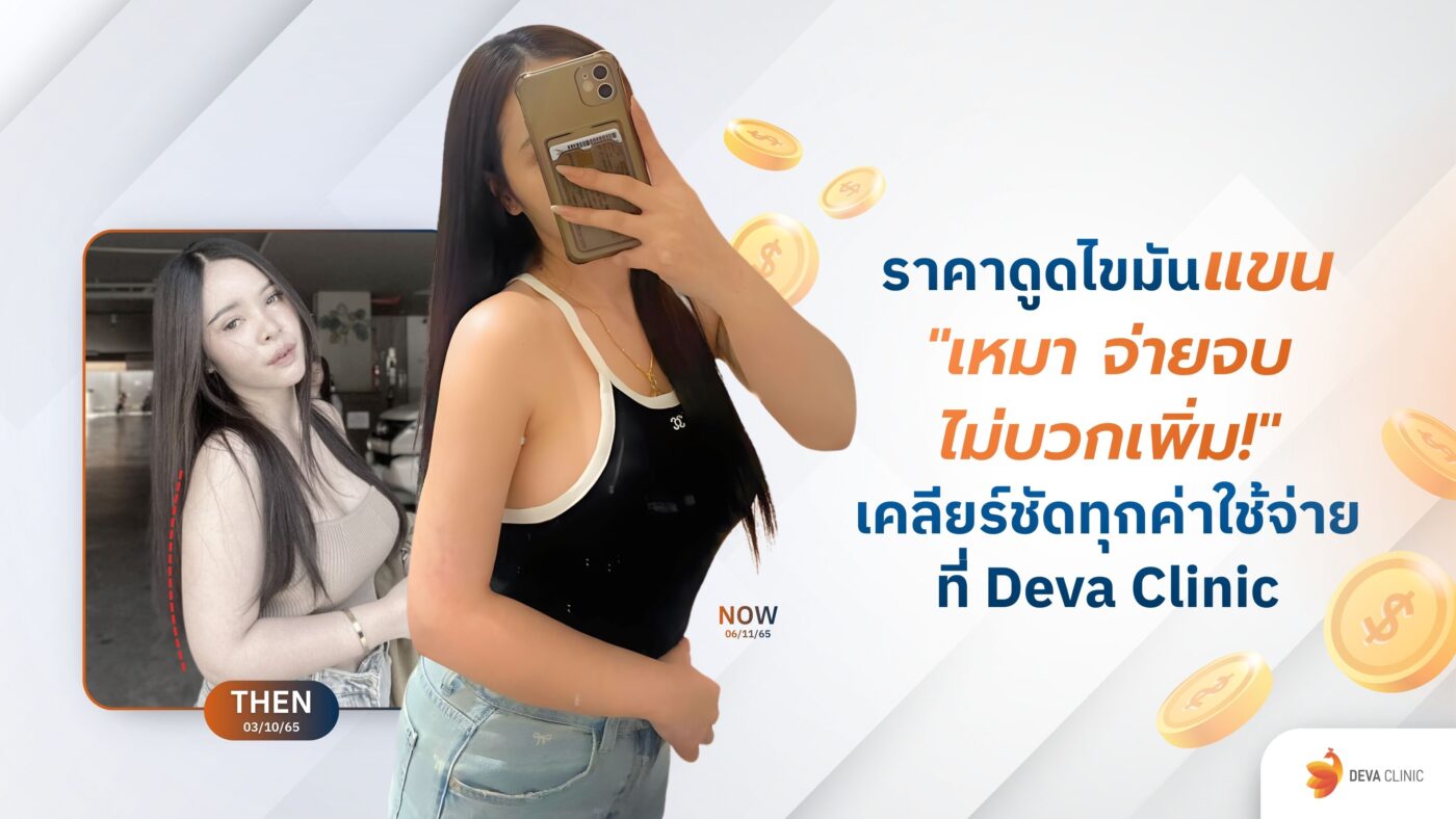 ราคาดูดไขมันแขน เหมา